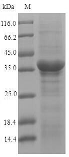 Dihydroxyacetone kinase (dhaK), partial, Recombinant Protein 