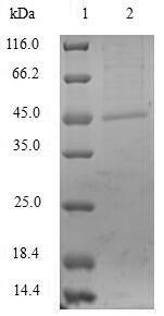 Beta-lactamase IMP-1, Recombinant Protein 