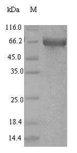 Long-chain-fatty-acid--CoA ligase 5 (ACSL5), Recombinant Protein