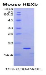 Hexosaminidase B Beta (HEXb), Recombinant Protein