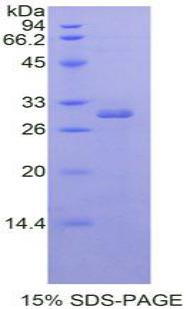 RAR Related Orphan Receptor Alpha (RORa), Recombinant Protein