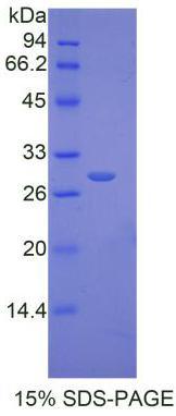 Collagen Type I Alpha 1 (COL1a1), Recombinant Protein For Research Use ...