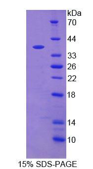 Glutamate Carboxypeptidase II (GCPII), Recombinant Protein