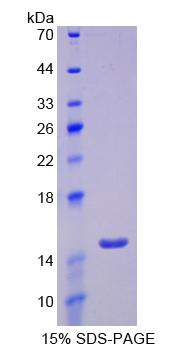 Glucose Transporter 14 (GLUT14), Recombinant Protein For Research Use ...