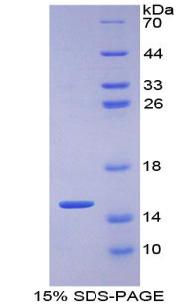 Glucose Transporter 1 (GLUT1), Recombinant Protein For Research Use ...