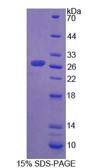 Chymotrypsinogen B1 (CTRB1), Recombinant Protein