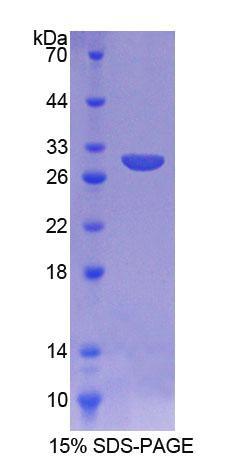 Aspartylglucosaminidase (AGA), Recombinant Protein For Research Use ...