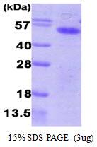 Aurora kinase A (AURKA), Recombinant Protein