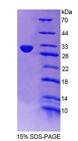 Aurora Kinase C (AURKC), Recombinant Protein