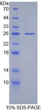 Apolipoprotein B100 (APOB100), Recombinant Protein For Research Use ...