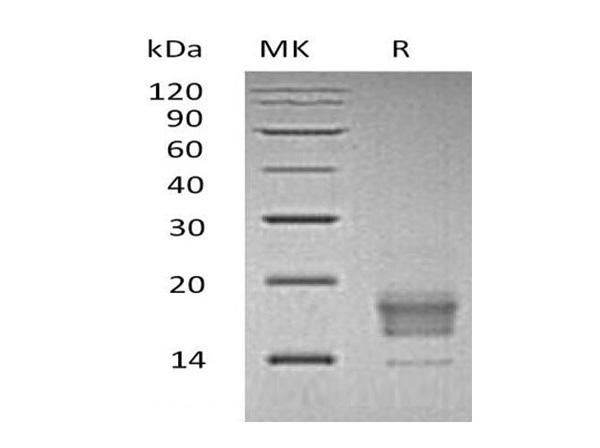 T Cell Immunoreceptor With Ig and ITIM Domains (TIGIT), Recombinant Protein