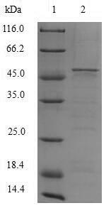 Cytochrome b-245 heavy chain (CYBB), Recombinant Protein