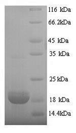 Erythropoietin (EPO), Recombinant Protein 