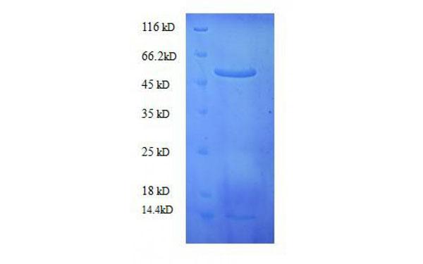 RuBisCO, Native Protein