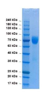 HA Trimer (H3N2)(A/Hong Kong/1/1968), Recombinant Protein