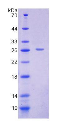 Carnitine Acylcarnitine Translocase (CACT), Recombinant Protein For ...