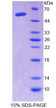 Aminoadipate Semialdehyde Synthase (AASS), Recombinant Protein