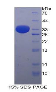 Arrestin Beta 1 (ARRb1), Recombinant Protein