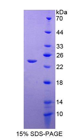 Squamous Cell Carcinoma Antigen 1/2 (SCCA1/SCCA2), Recombinant Protein ...